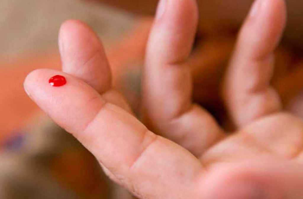 El 75 % de pacientes con hemofilia en México desconocen su condición