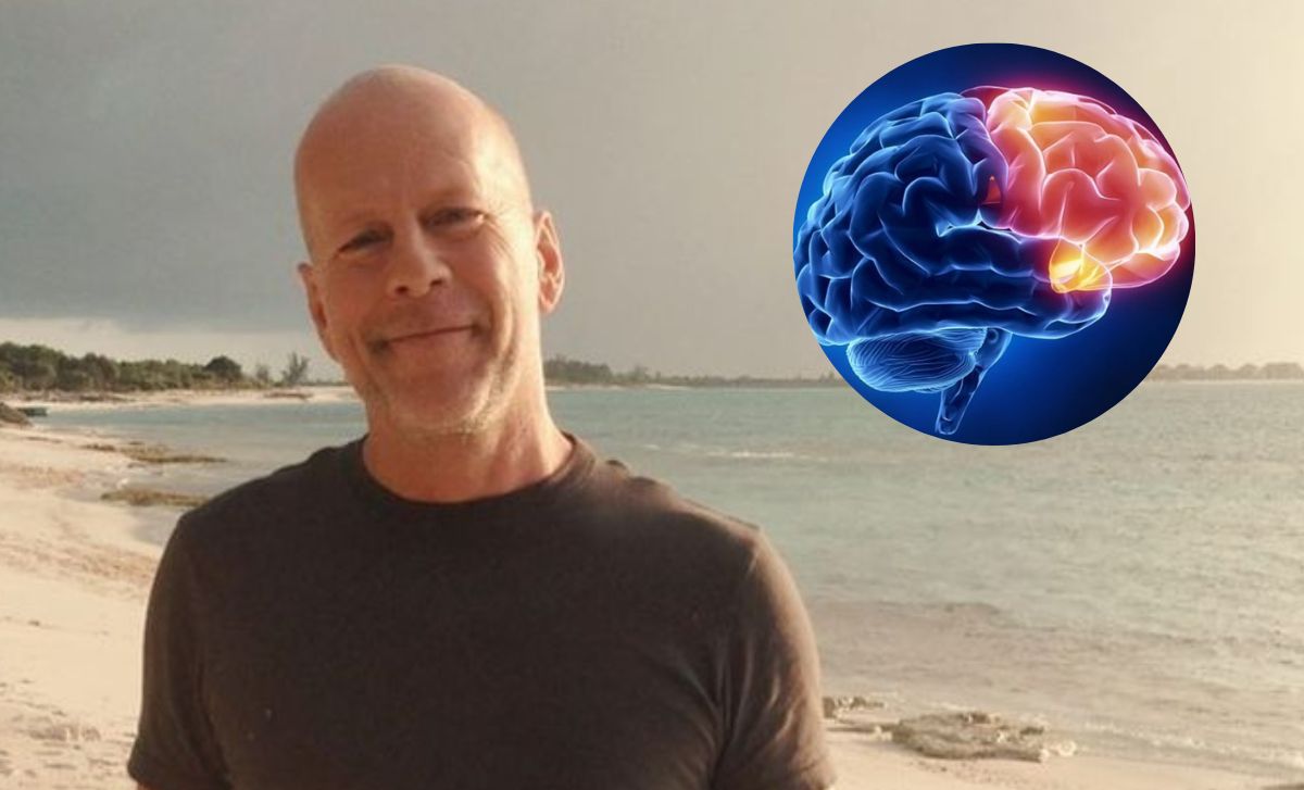 Demencia frontotemporal: Esta es la enfermedad que le diagnosticaron a Bruce Willis