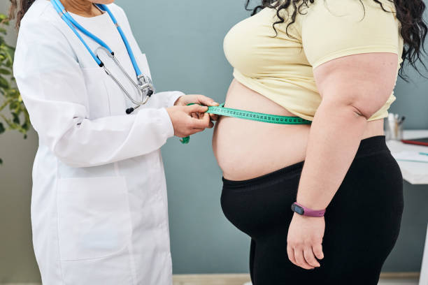 La obesidad, un factor de riesgo para el cáncer, varía según sexo y tipo de tumor
