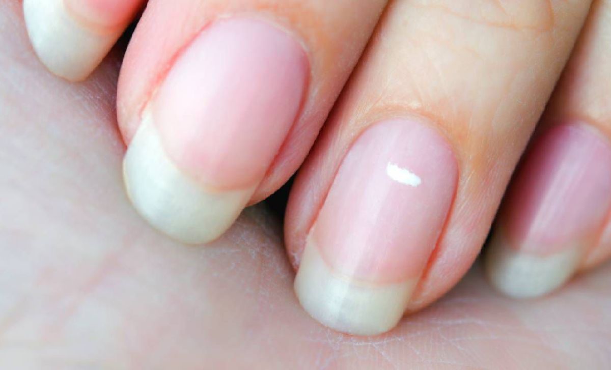 ¿Líneas blancas en las uñas? Esta es la vitamina de la que tienes deficiencia