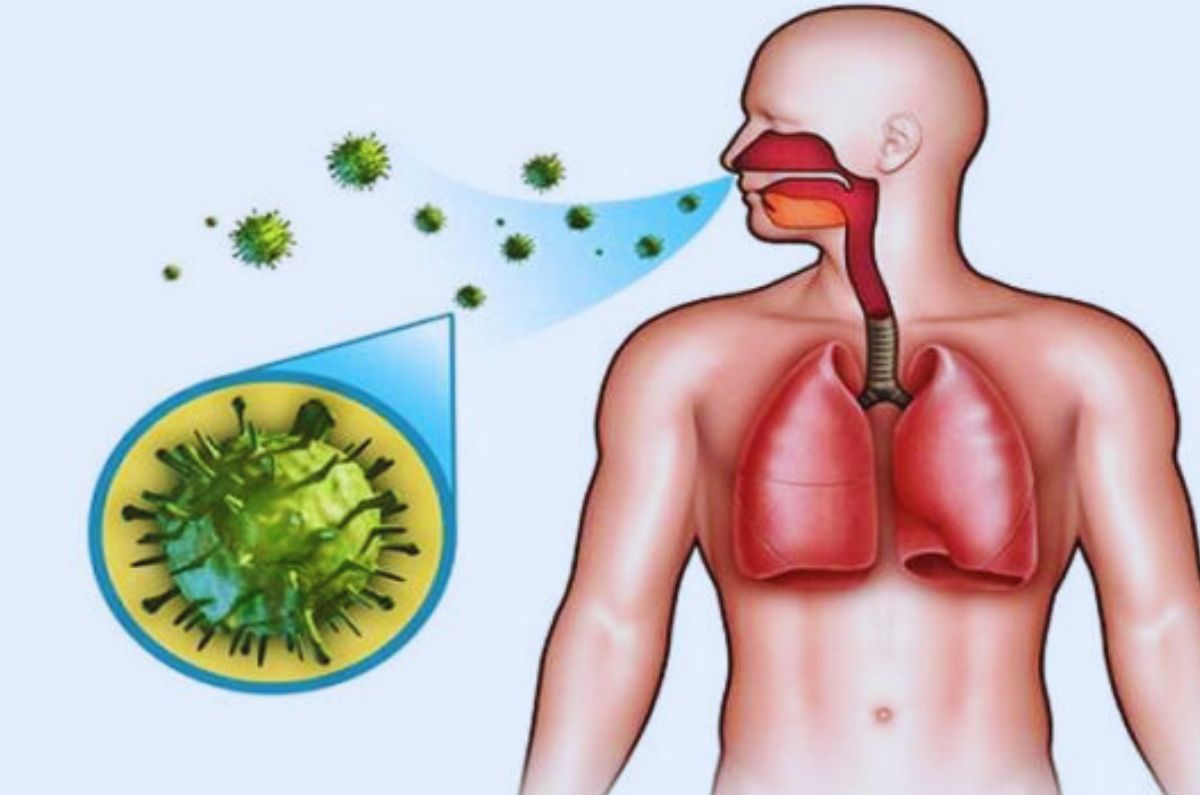 Bronquitis: síntomas y mejores prácticas de tratamiento