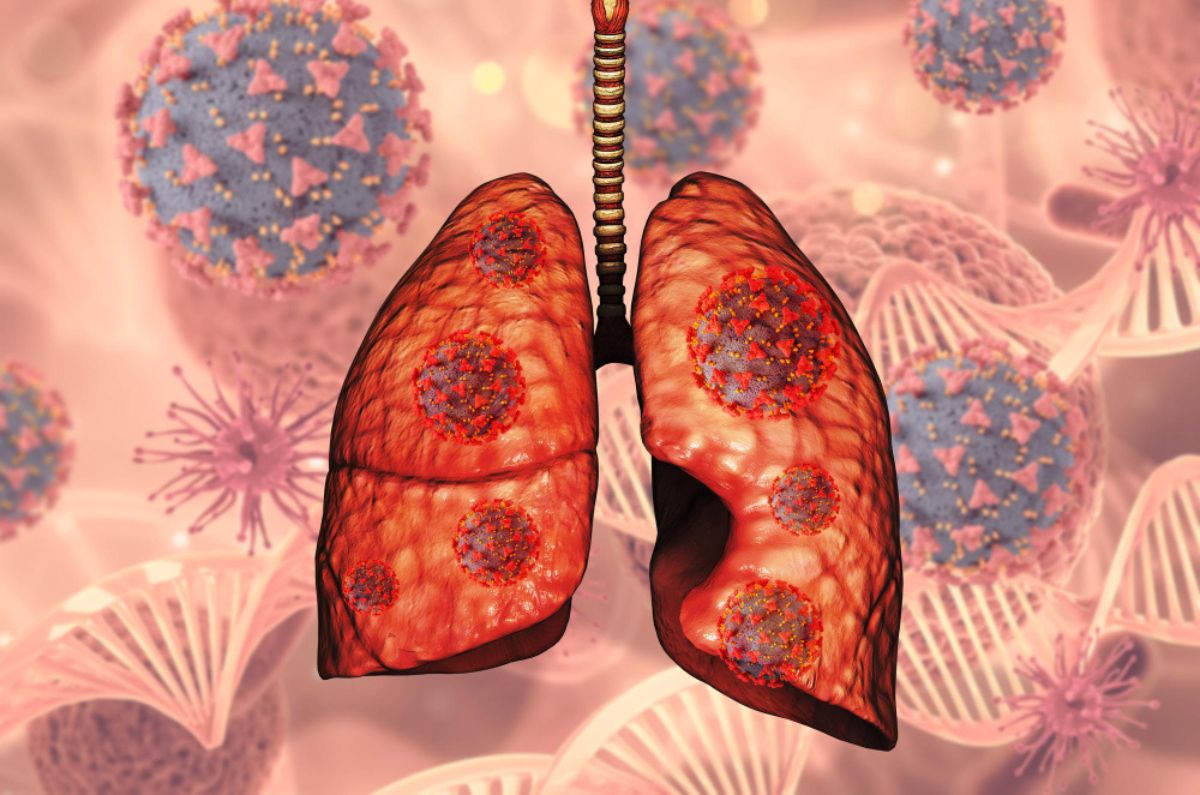 Cáncer de pulmón, lo que hay que saber sobre el tema