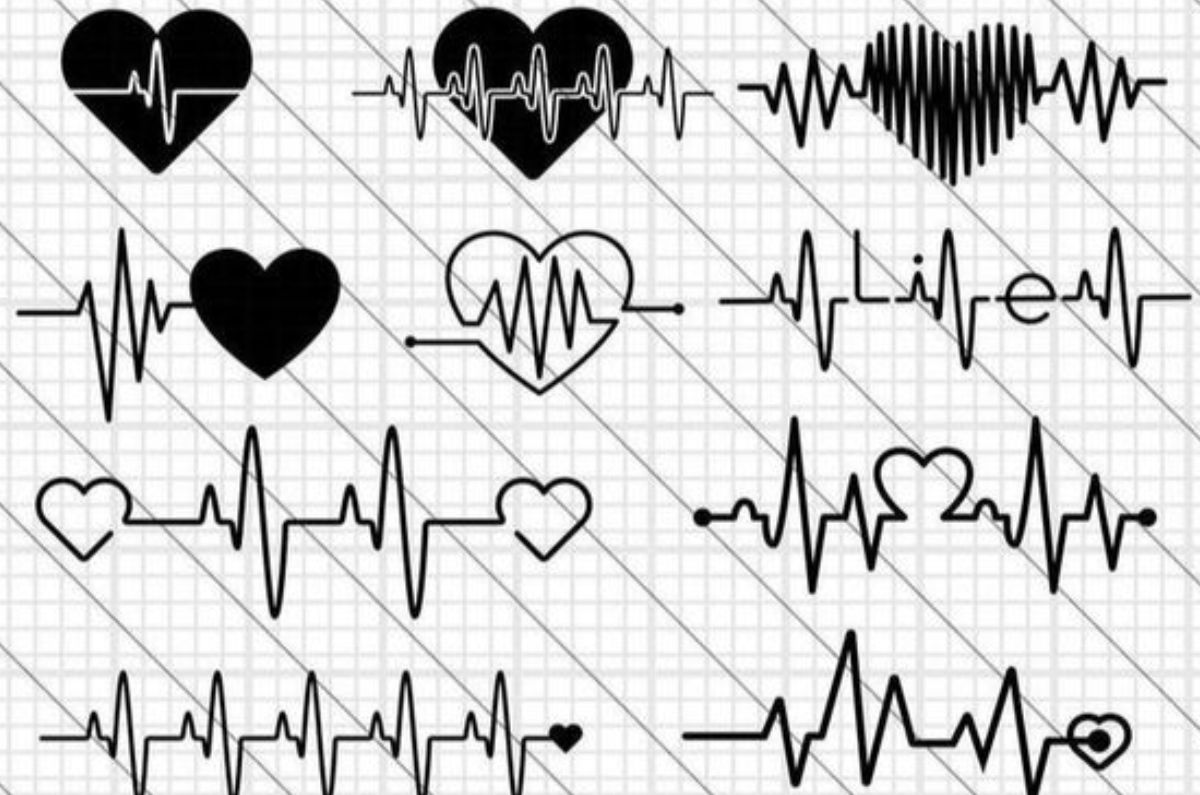 Electrocardiograma: Útil para evaluar la salud del corazón