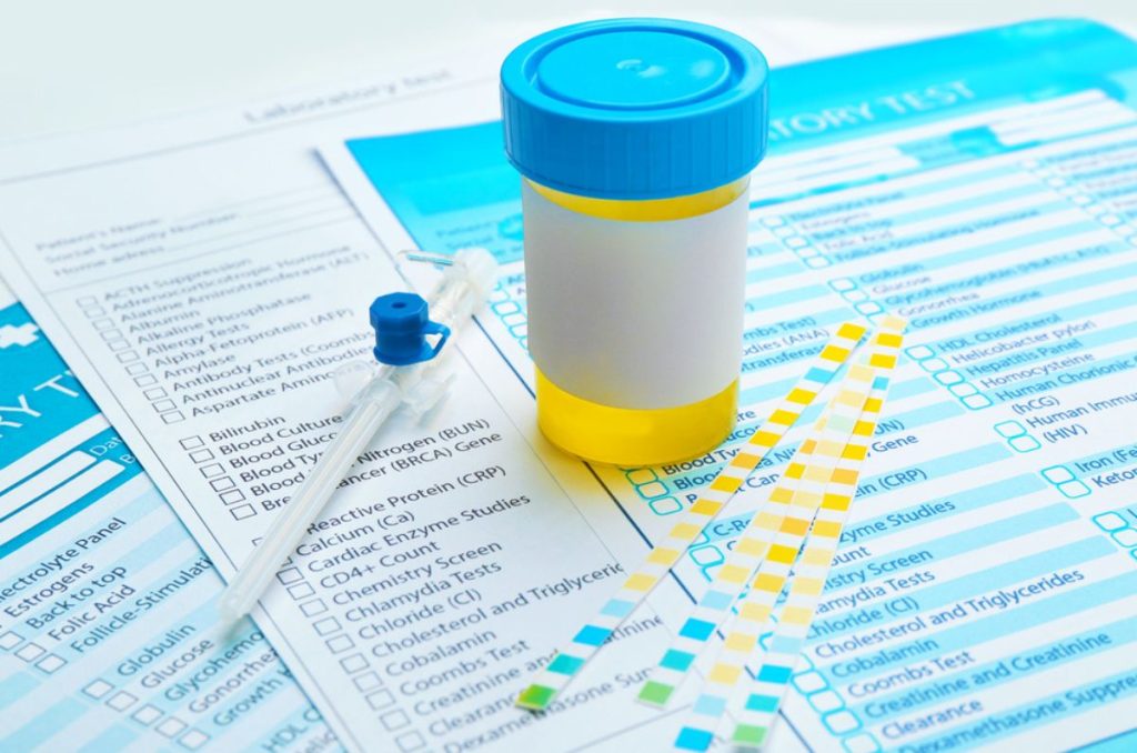 Examen general de orina