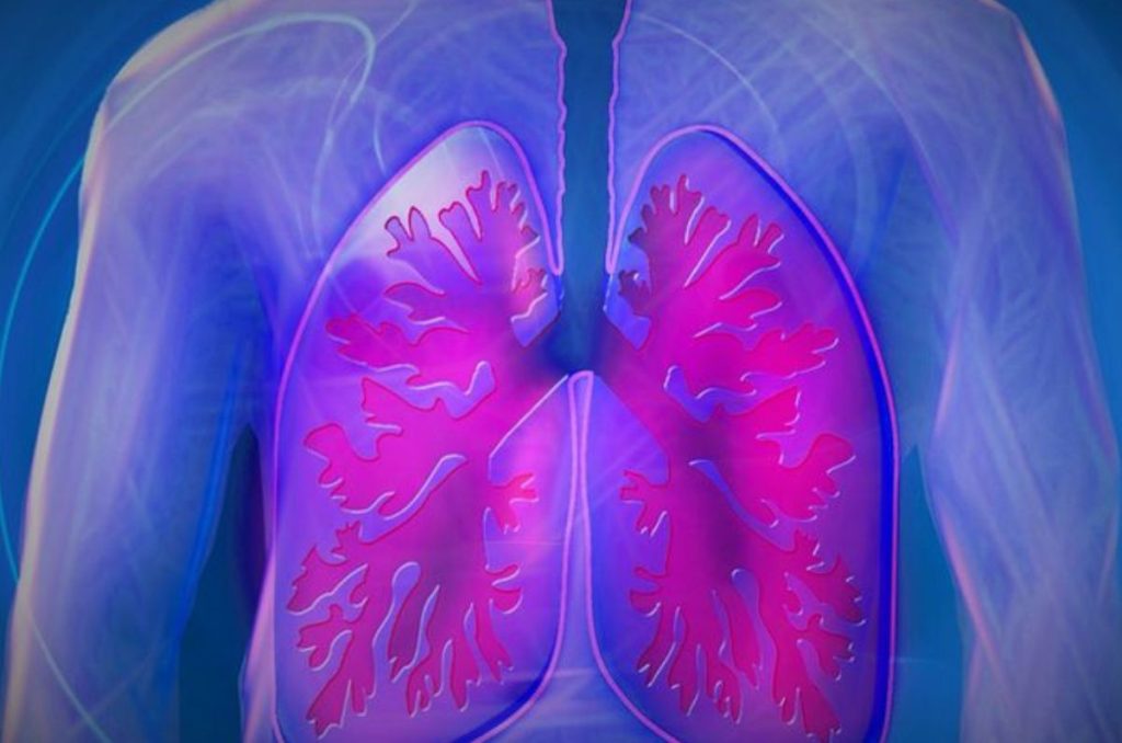 Hipertensión pulmonar
