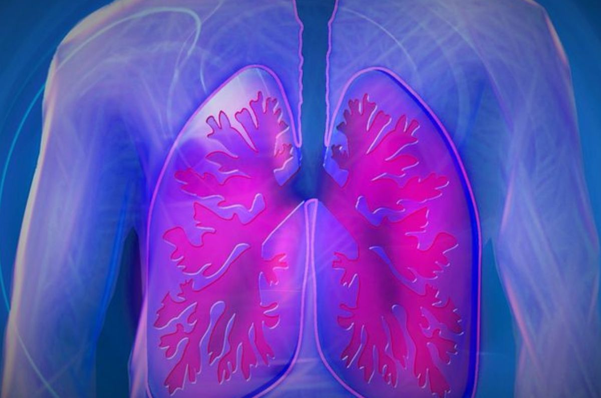 Hipertensión pulmonar: Síntomas y tratamientos eficaces