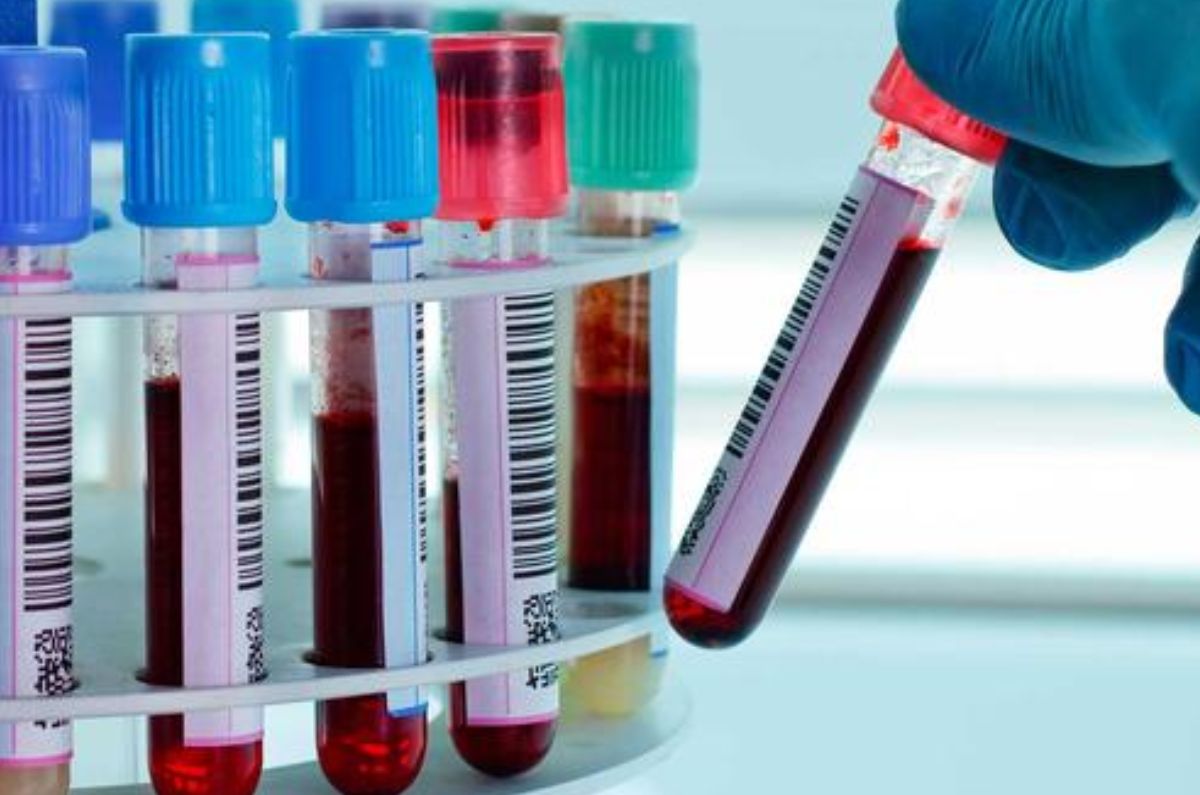 Química sanguínea: Entendiendo los indicadores clave