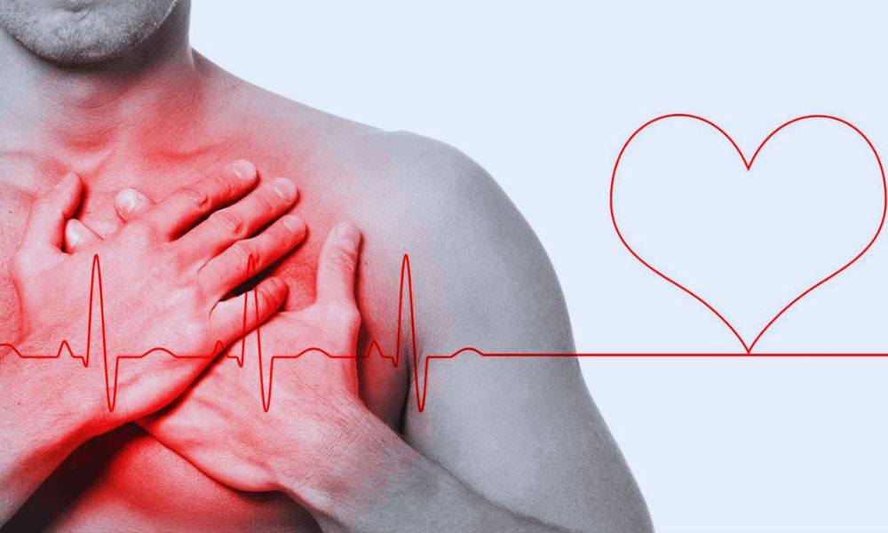 Cardiopatía isquémica, síntoma de dolor de pecho