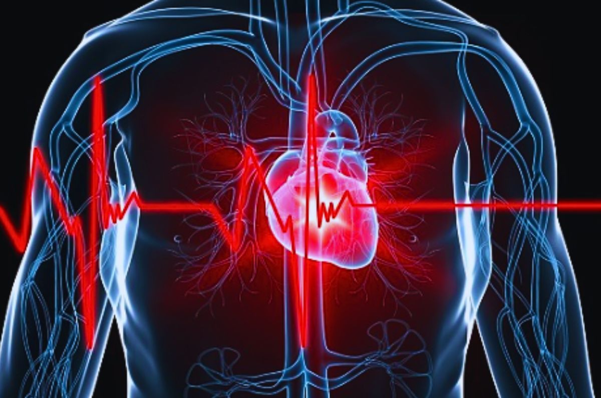 Cardiopatía isquémica: Causas, síntomas y opciones de tratamiento