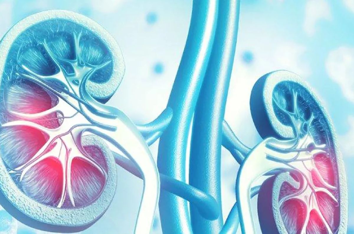 Enfermedad renal crónica: La alerta silenciosa en los riñones