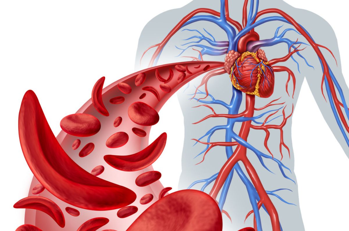 La anemia falciforme y cómo podemos afrontarla