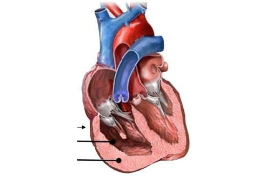 Cor pulmonale