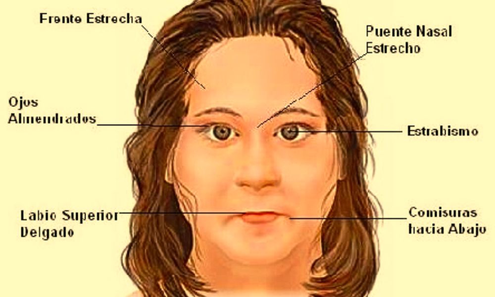 SPW caracteristicas faciales