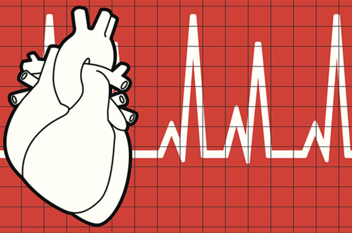 Soplo en el corazón: Comprender el sonido cardíaco anormal