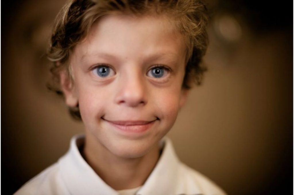 Síndrome de Williams