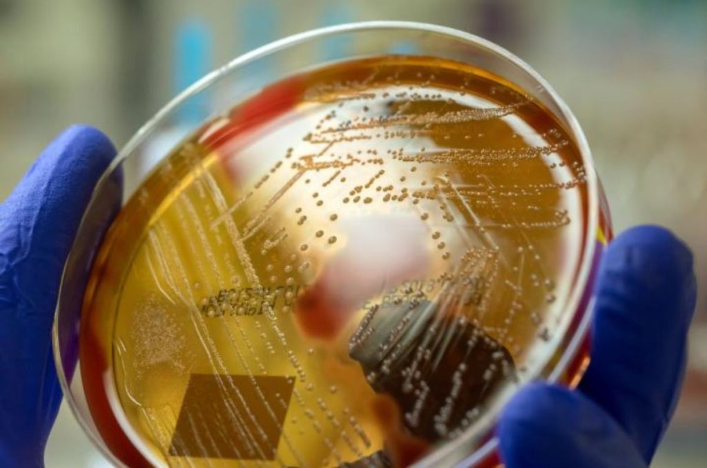 ¿Se aproxima una nueva pandemia? Autoridades sanitarias se mantienen en alerta ante un brote de bacteria 'carnívora' potencialmente mortal.