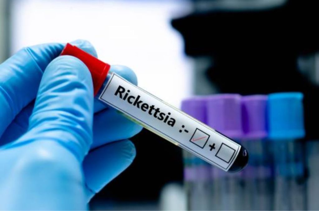 En México varios estados se encuentran en alerta debido a casos de rickettsia, enfermedad que ya cobró vidas; entérate a detalle.