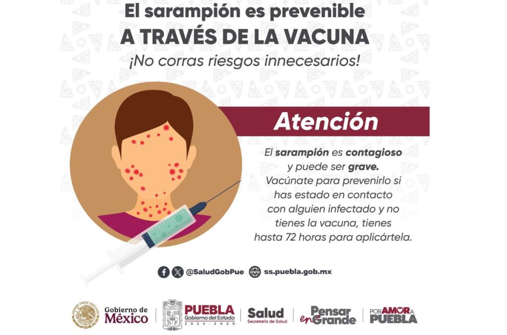 Vacuna contra el Sarampión